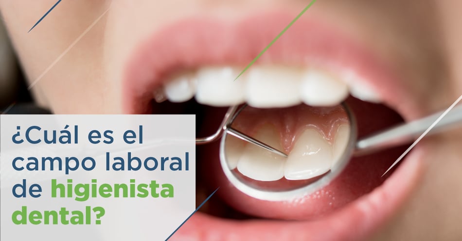 Campo laboral de un higienista dental